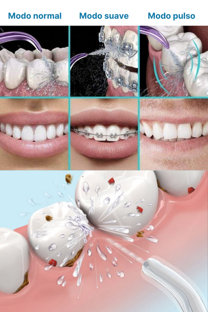 HYDRO PULSE (DUCHA DENTAL) + CEPILLO ULTRASÓNICO (6 MODOS) INTELIGENTE DE REGALO 🎁