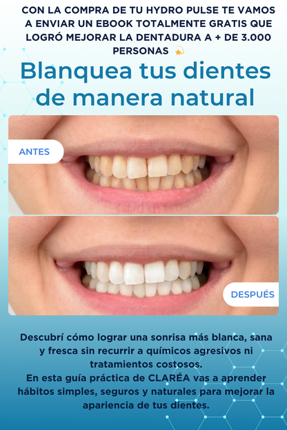 HYDRO PULSE (DUCHA DENTAL) + CEPILLO ULTRASÓNICO (6 MODOS) INTELIGENTE DE REGALO 🎁